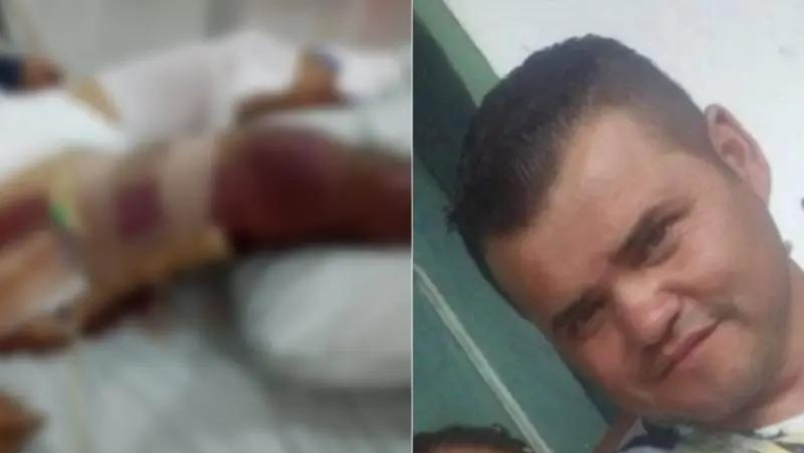 Hombre ingresa al hospital por un “mugre en el ojo” y fallece inesperadamente