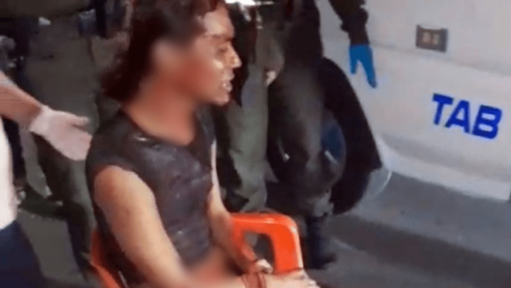 Brutal agresión deja a ‘Shakira’ con amputación parcial de una de sus extremidades