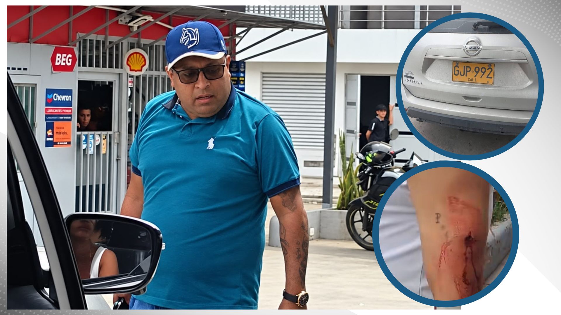 Hombre hirió con arma traumática a una persona en el barrio el Salado en Ibagué Hombre hirió con arma traumática a una persona en el barrio el Salado en Ibagué